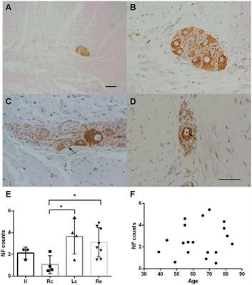 Alpha-Synuclein Accumulation and Its Phosphorylation in the Enteric Nervous System of Patients Without Neurodegeneration: An Explorative Study